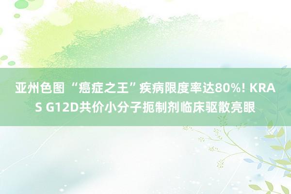 亚州色图 “癌症之王”疾病限度率达80%! KRAS G12D共价小分子扼制剂临床驱散亮眼